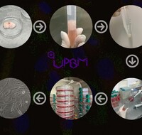 Этапы выделения мезенхимальных стволовых клеток из жировой ткани